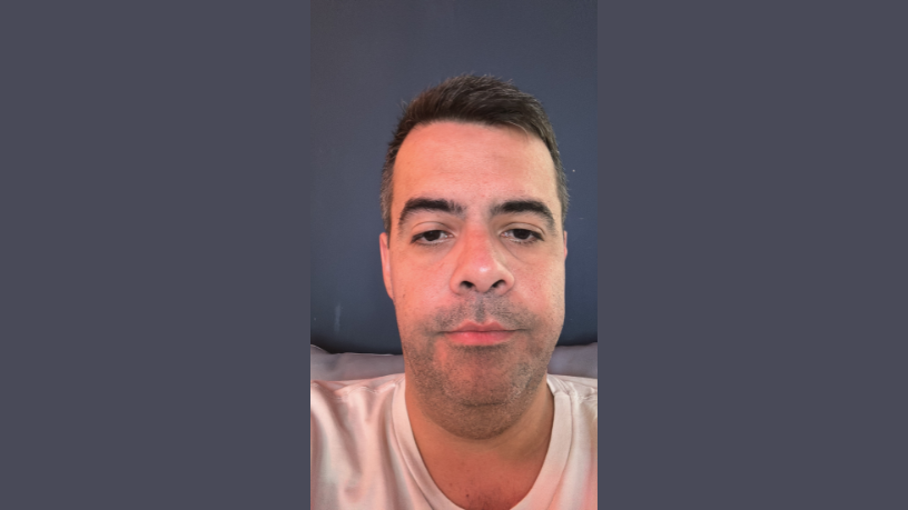 Entenda como a padronização na mamografia diminui falsos negativos e aumenta a confiabilidade dos exames, segundo Vinicius Tadeu Sattin Rodrigues.